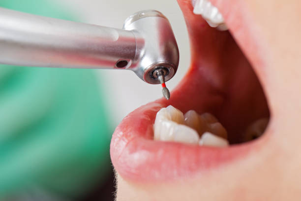 Best Emergency Dentist for Lost Fillings or Crowns in Crab Orchard, WV
